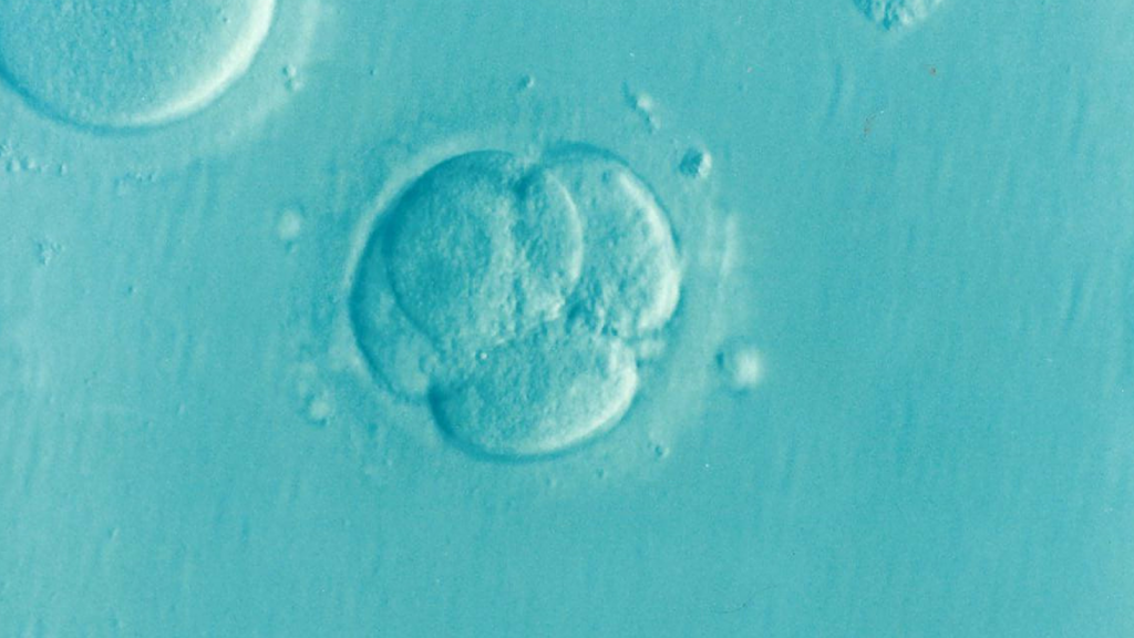 embryo, ivf, microfertilization
