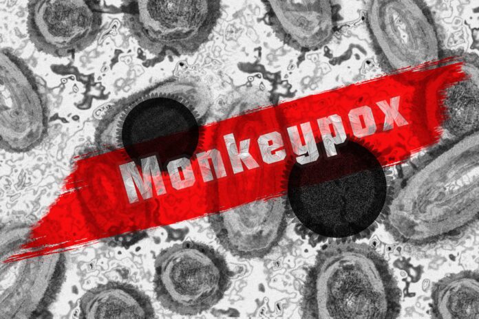monkey pox, monkeypox virus, virus